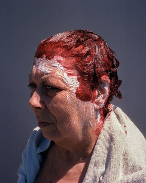  - Image 1 of 8