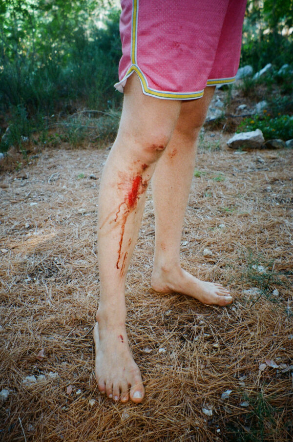  - Image 2 of 8