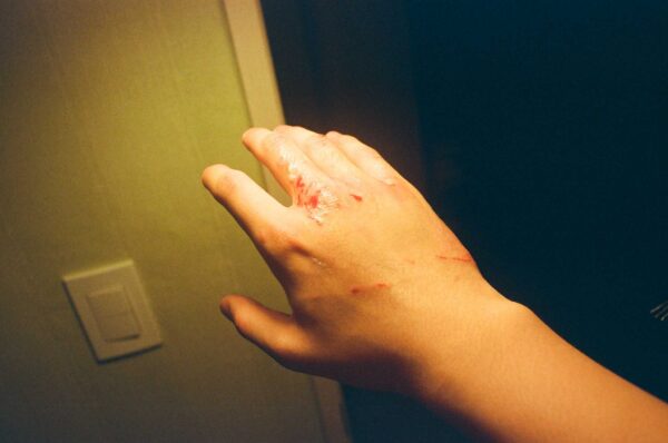  - Image 1 of 8