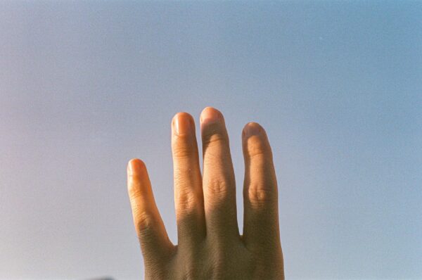  - Image 2 of 8