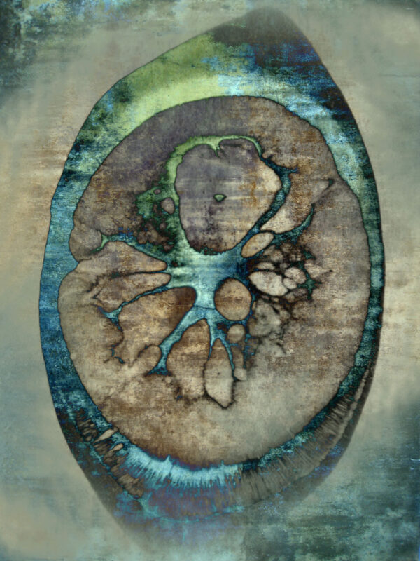  - Image 1 of 4
