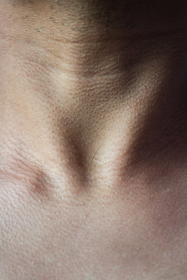  - Image 6 of 8